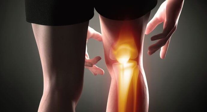 Symptoms of arthrosis