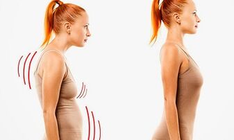 The reasons for the development of cervical osteochondosis