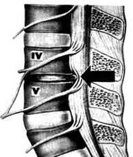 X -Ray Image of the Lumbar Department of Osteochondosis